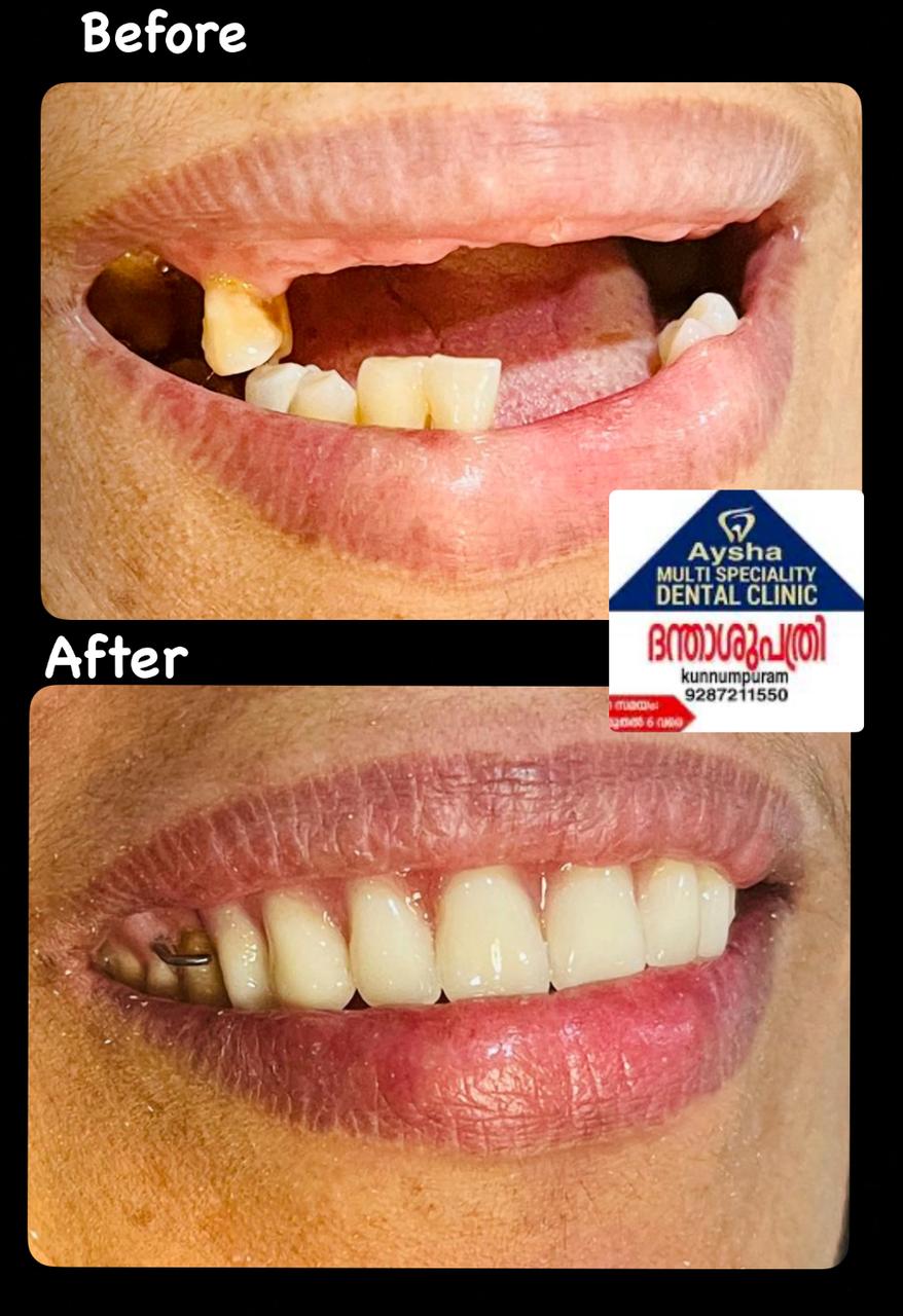 Aysha Dental Speciality Clinic